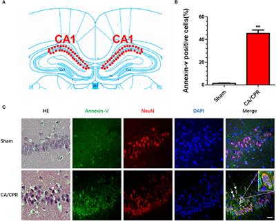 CTL-Derived Granzyme B Participates in Hippocampal Neuronal Apoptosis Induced by Cardiac Arrest and Resuscitation in Rats